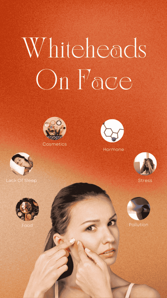 Causes of Whiteheads on face
