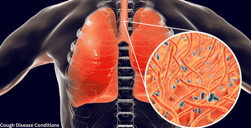 Dry Cough Disease