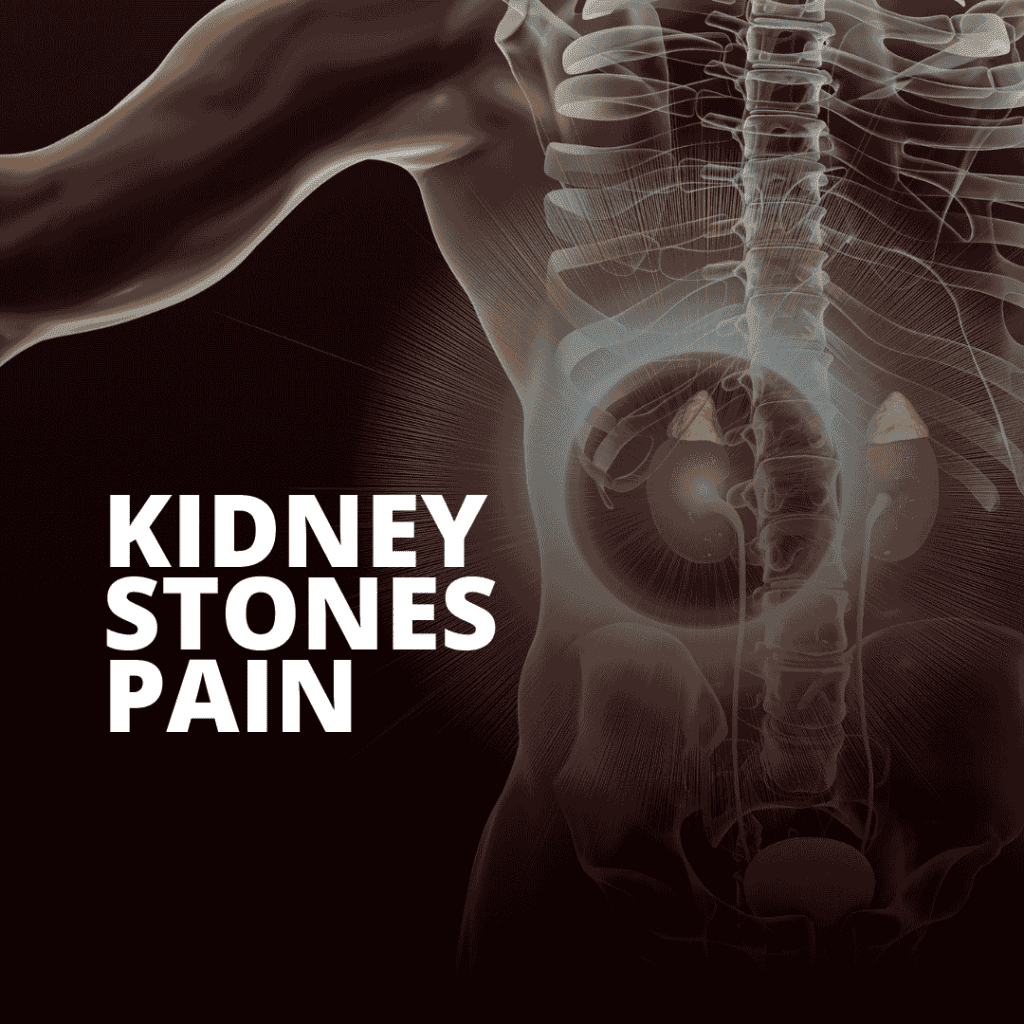 Kidney Stone