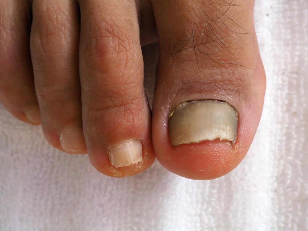 Nail Growth is Stagnant