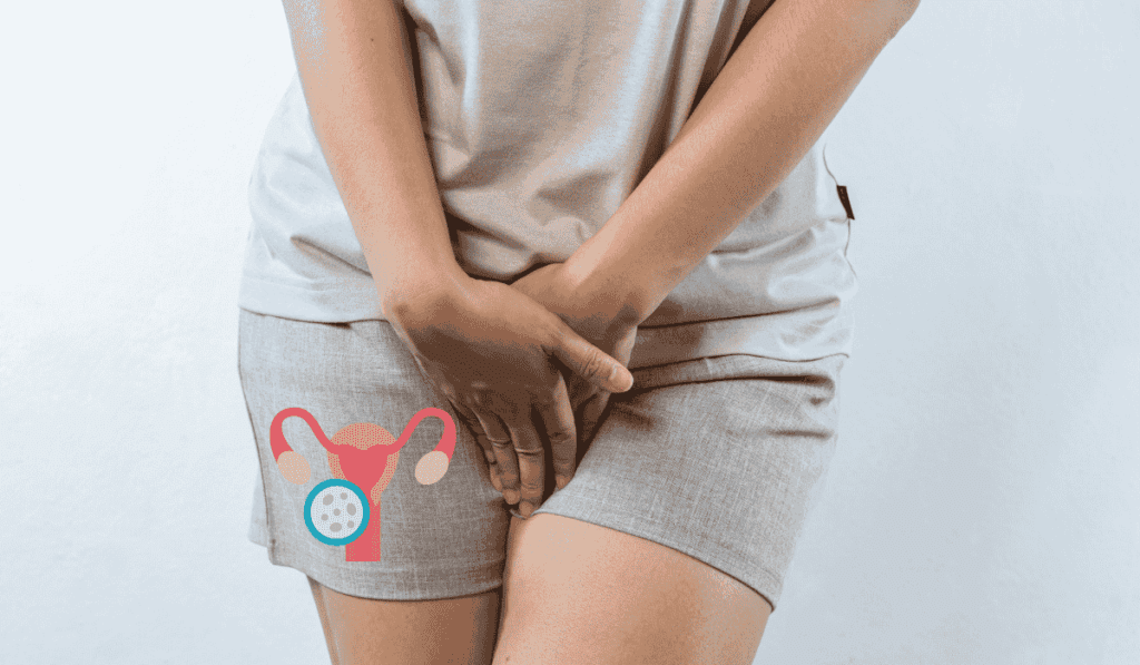 Signs and Symptoms of BV Bacterial Vaginosis