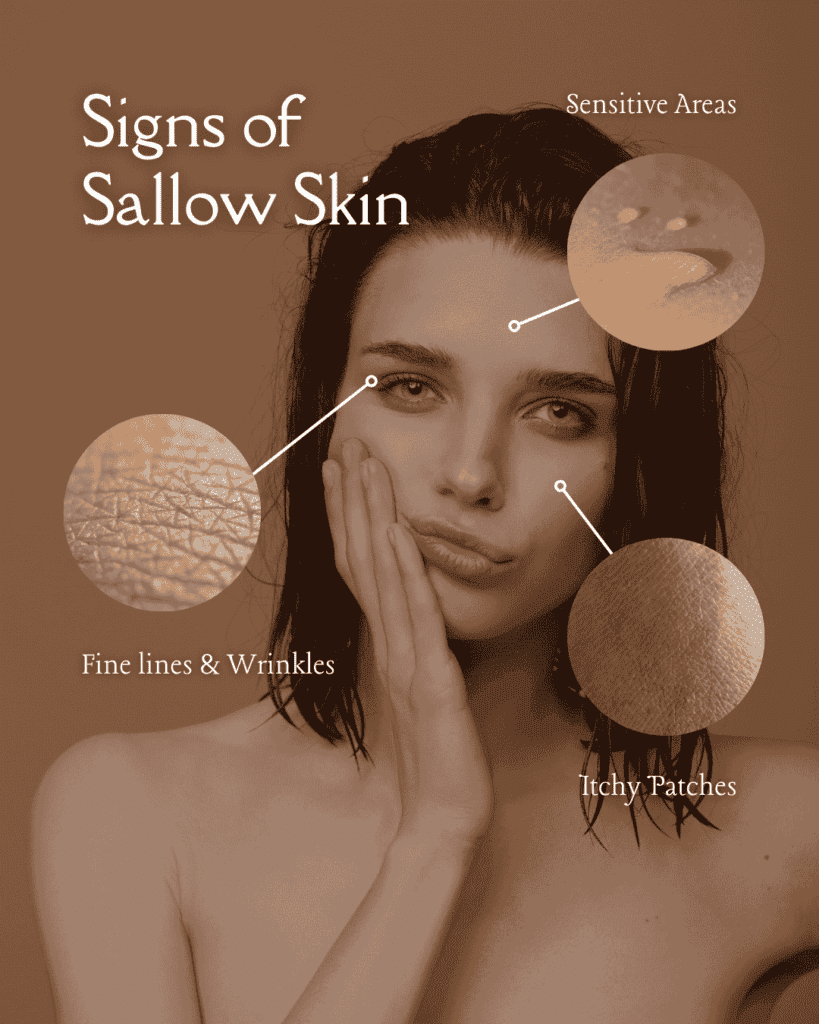 Signs of Sallow Skin