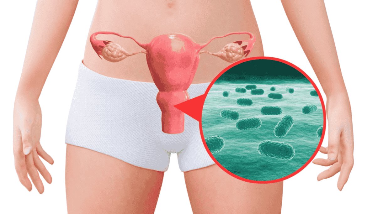 Top BV Bacterial Vaginosis Signs & Symptoms You Must Not Ignore